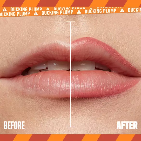 Vorher-Nachher-Vergleich von Lippen, der Unterschied in Fulle und Farbe zeigt sich deutlich in der Bildmitte.