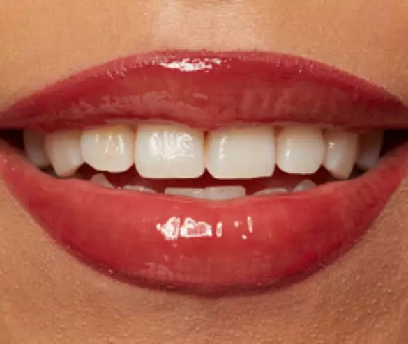 Nahaufnahme von lachelnden Lippen mit rotem Lipgloss und weißen Zahnen