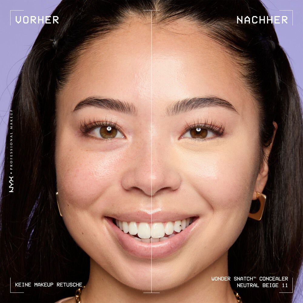 Ein unretuschierter Vorher-Nachher-Vergleich im Split-Screen demonstriert die hohe Deckkraft des NYX Wonder Snatch™ Concealers.