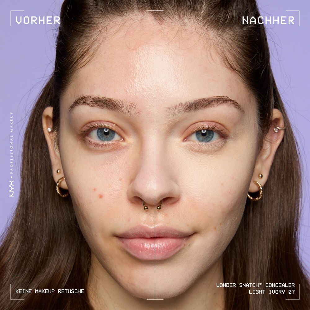 Ein unretuschierter Vorher-Nachher-Vergleich im Split-Screen demonstriert die hohe Deckkraft des NYX Wonder Snatch™ Concealers.