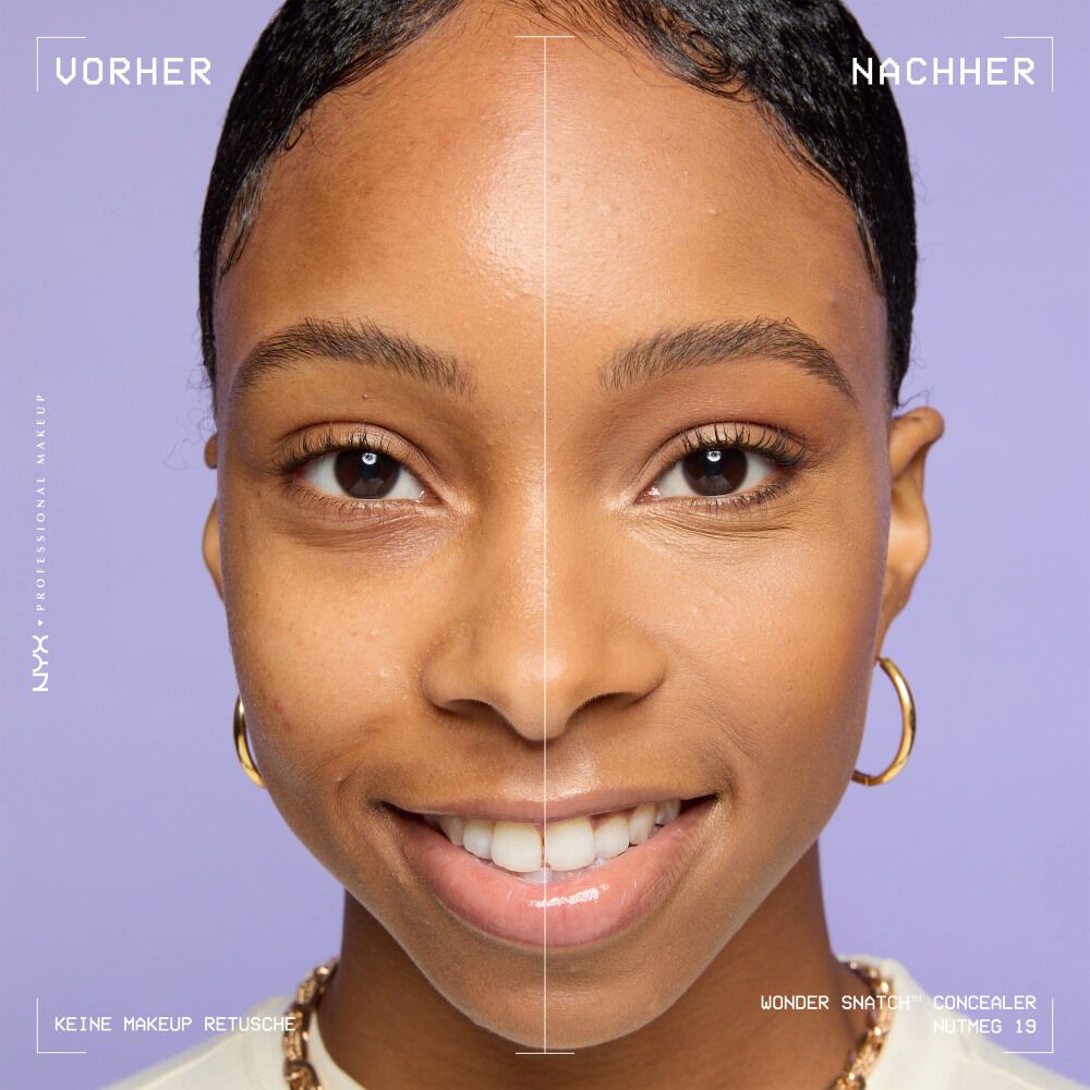 Ein unretuschierter Vorher-Nachher-Vergleich im Split-Screen demonstriert die hohe Deckkraft des NYX Wonder Snatch™ Concealers.
