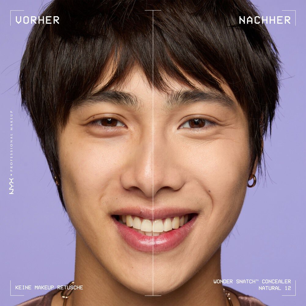 Ein unretuschierter Vorher-Nachher-Vergleich im Split-Screen demonstriert die hohe Deckkraft des NYX Wonder Snatch™ Concealers.