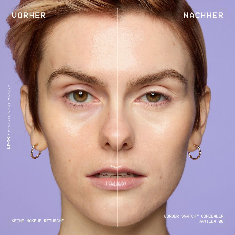Ein unretuschierter Vorher-Nachher-Vergleich im Split-Screen demonstriert die hohe Deckkraft des NYX Wonder Snatch™ Concealers.