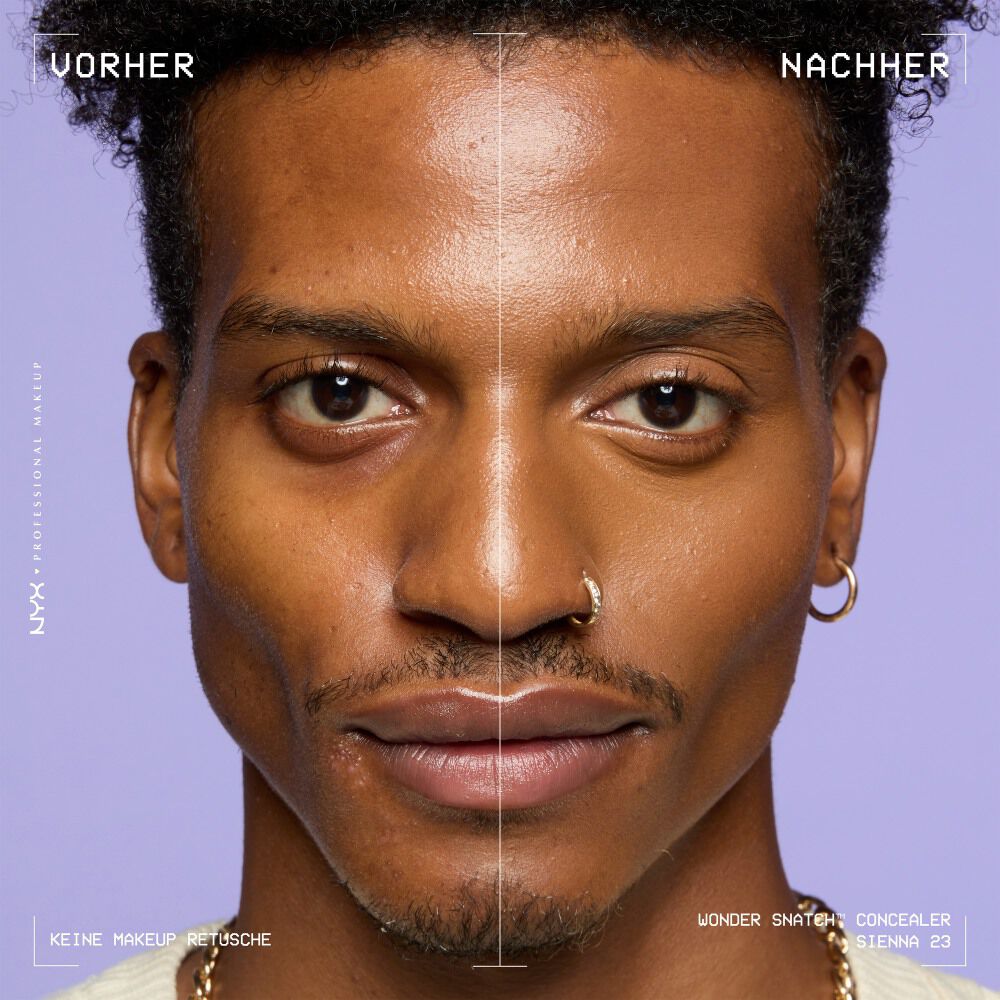 Ein unretuschierter Vorher-Nachher-Vergleich im Split-Screen demonstriert die hohe Deckkraft des NYX Wonder Snatch™ Concealers.