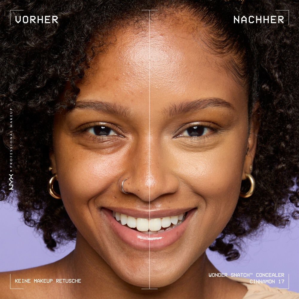Ein unretuschierter Vorher-Nachher-Vergleich im Split-Screen demonstriert die hohe Deckkraft des NYX Wonder Snatch™ Concealers.