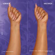 Ein Vorher-Nachher-Vergleich, der den Effekt an einen Arm zeigt.