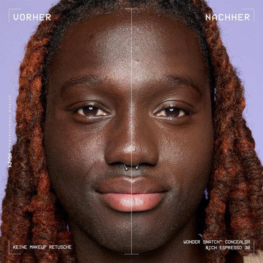 Ein unretuschierter Vorher-Nachher-Vergleich im Split-Screen demonstriert die hohe Deckkraft des NYX Wonder Snatch™ Concealers.