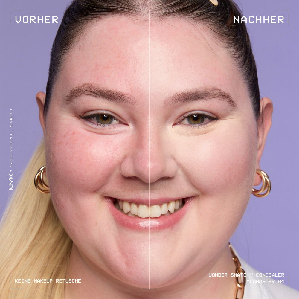 Ein unretuschierter Vorher-Nachher-Vergleich im Split-Screen demonstriert die hohe Deckkraft des NYX Wonder Snatch™ Concealers.